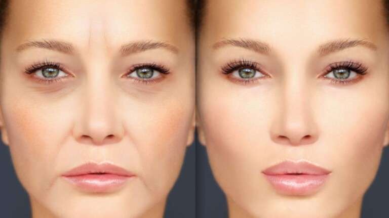 botox-profylaxeis-hero